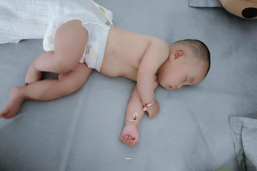 泉州宝宝脸上有白色斑块